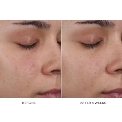 Pore Refining Complex