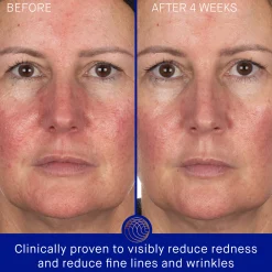 The Hydrogel Face Mask 6 Pack