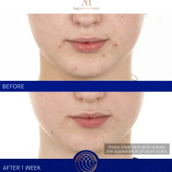 The Retinol Serum